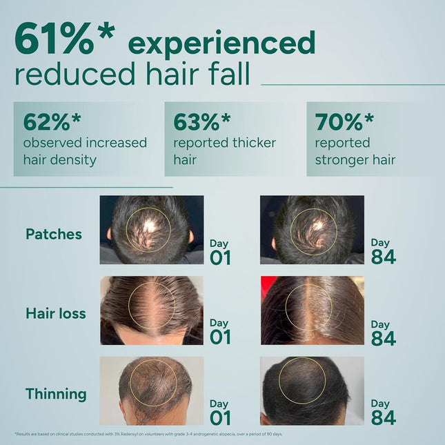 Arata Hair Growth Serum for Scalp Women & Men | 30ml