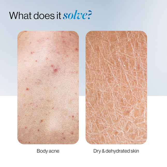 Be Bodywise 1% Salicylic Ceramide Body Wash Shower Gel 200ml