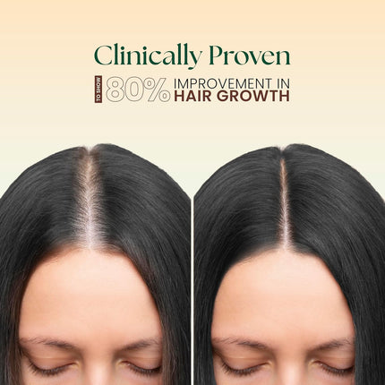 Moha 5-in-1 Hair Oil | Blend of Rosemary, Coconut, Argan, Jojoba & Almond Oil