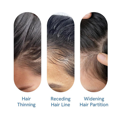 Be Bodywise Rosemary Hair Growth Serum (Roll On) | 3% Redensyl & 2% Anagain