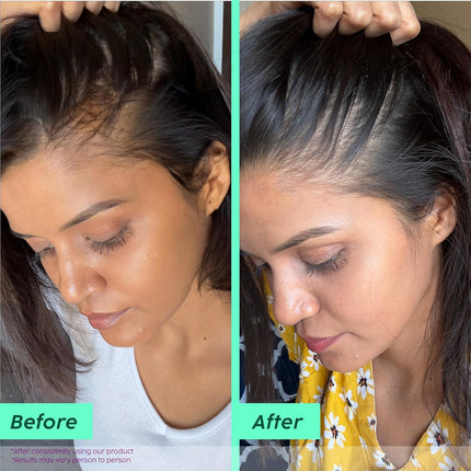 The Plant Fix Plix Rosemary Advanced Anti HairFall Shampoo for Decreases Hair Fall & Breakage - 200 ml