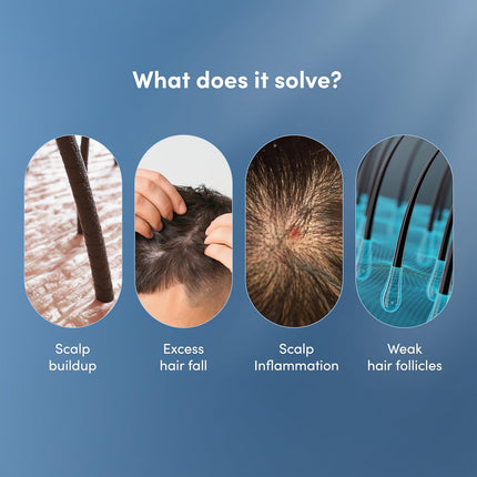 Man Matters Dht Blocking Anti Hair Fall Shampoo-300ml