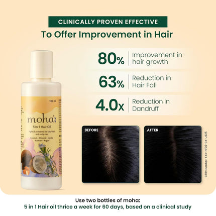 Moha 5-in-1 Hair Oil | Blend of Rosemary, Coconut, Argan, Jojoba & Almond Oil