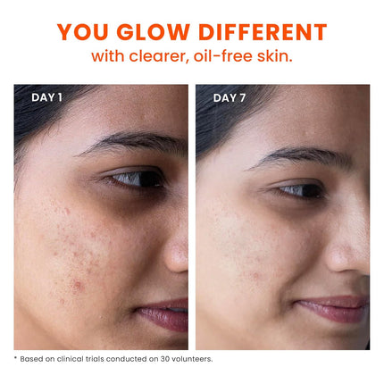 Foxtale Oil and Acne Control Face Wash | 2% Salicylic Acid + Niacinamide + Cica + Hyaluronic Acid