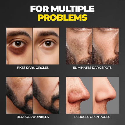 Beardo Ultra Glow Brightening Face Serum  Men  15% Niacinamide, Vitamin C, Glutathione | 30ml