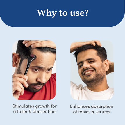 Man Matters Derma roller 1.00 mm With 540 Titanium Alloy Needles