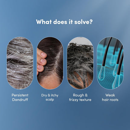 Man Matters Advanced Daily Use Anti Dandruff Shampoo with Rosemary 200ml