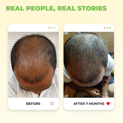 Avimee Herbal Keshpallav Hair Oil for Hair Growth-100ml