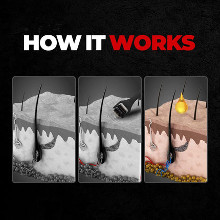 Beardo Beard & Hair Growth Oil 50ml & Derma Roller For Hair Growth 0.5 mm| Dermaroller