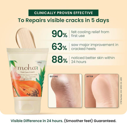 Moha Foot Cream for Dry & Cracked Feet-100gm