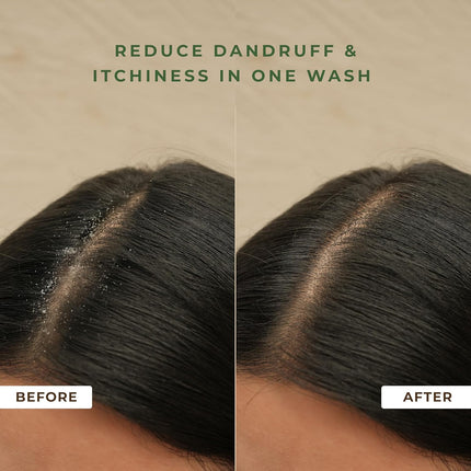 Naturali Australian Tea Tree Non-Drying Dandruff Defence Shampoo -200 ml