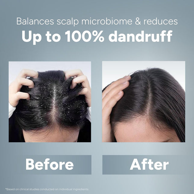 Arata Anti-Dandruff Shampoo | With Neem, Tea Tree Oil & Piroctone Olamine -200ml