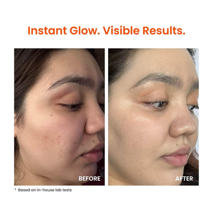 Foxtale Vitamin C Super Glow Moisturizer with Niacinamide & Peptides  50ml, Cream