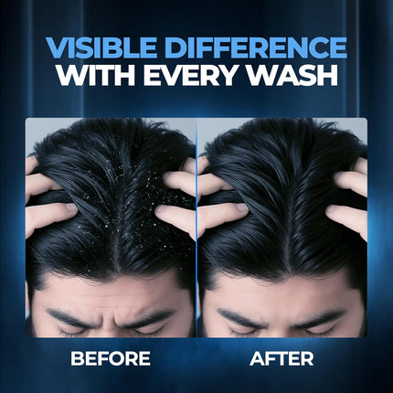 Beardo Dandruff Control Sulphate Free Shampoo for men 200 ml