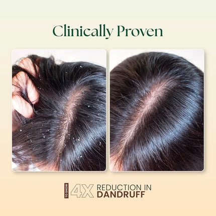 Moha 5-in-1 Hair Oil | Blend of Rosemary, Coconut, Argan, Jojoba & Almond Oil